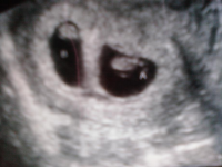 catscan.png